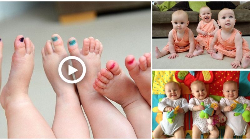 Because triplets are so similar, their parents color code their toe nails to distinguish them