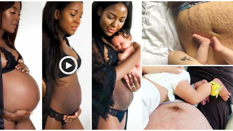 15 raw images of what most women’s postpartum bodies look like