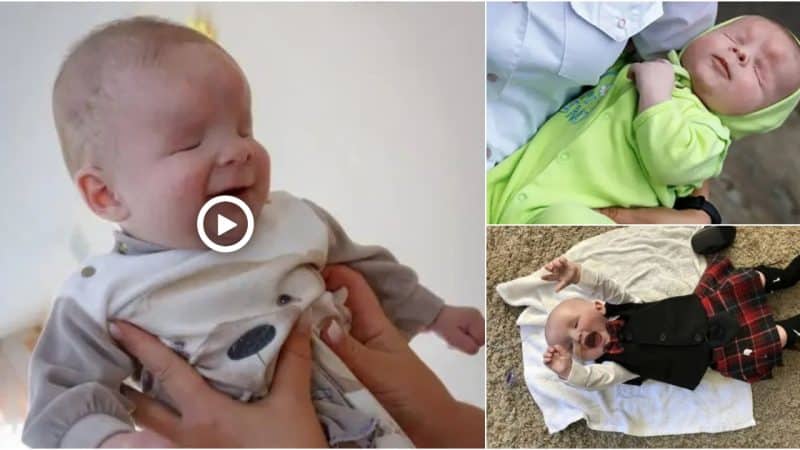 Finding a home for a baby abandoned because he was born without eyes