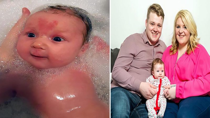 Strange Coincidence: Baby Conceived on Valentine’s Day Born with Heart-Shaped Birthmark on Face