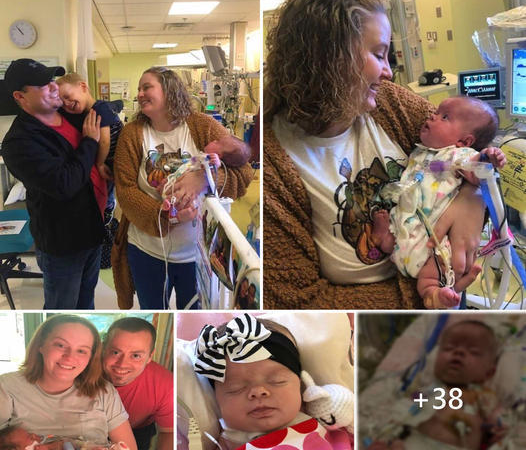 Mom Embraces the Arrival of Baby with Rare Thanatophoric Dysplasia