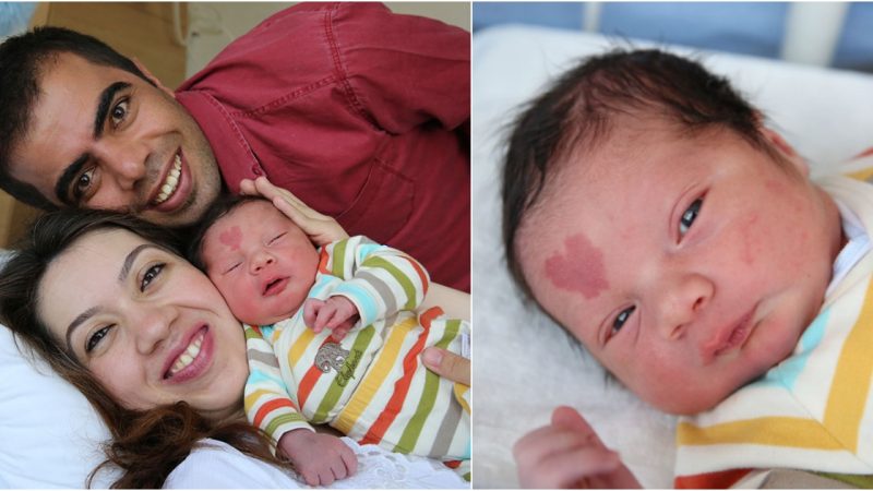 Baby Born with Unique ‘Heart’ Birthmark on Forehead Takes Social Media by Storm