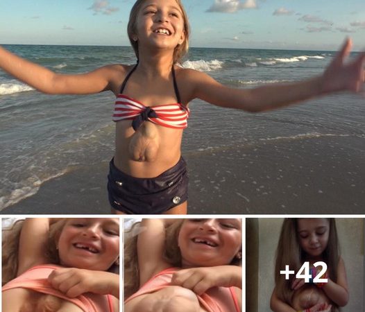 A Remarkable Journey of an 8-Year-Old Russian Girl Born with Her Heart Outside Her Chest