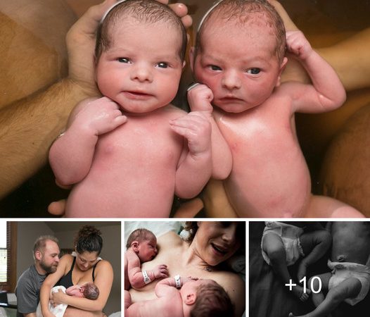 Embracing the Remarkable Experience of Twin Birth and Bonding Moments