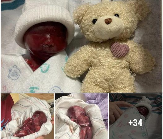 Emotional Heartache as Parents Witness Their Tiny Hand-Sized Baby