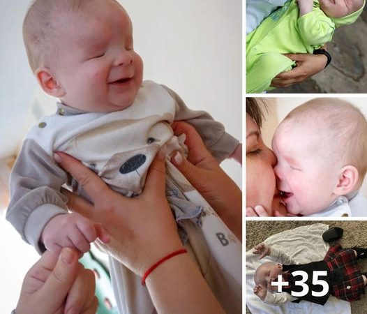 Joyful Infant Without Eyes, Abandoned by Mother, Finally Embraced by a Loving Home