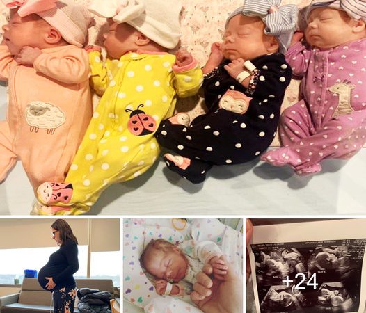 A Joyous Celebration: A Couple Welcomes Extremely Rare Identical Quadruplet Daughters