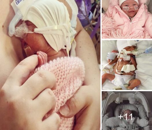 A Mother’s Heartache: Premature Baby Born 14 Weeks Early, Weighing as Light as a Sugar Cube