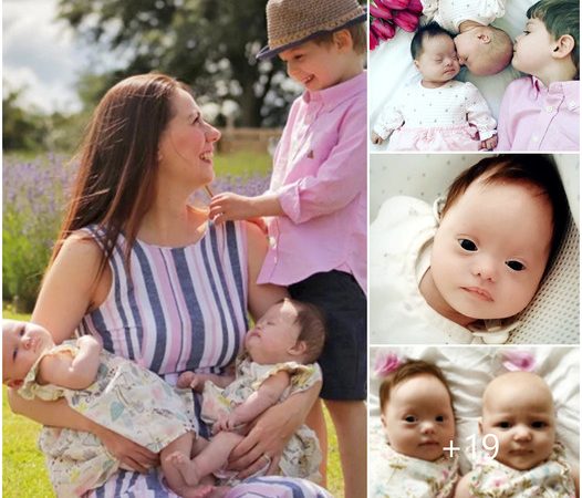 Incredible Miracles Unfold: Twins Celebrated as ‘One in a Million’ After Both Born with Down Syndrome