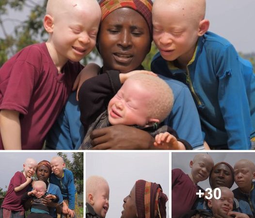 Unbreakable Bonds: A Mother’s Unrestricted Affection for Her Three Albino Children 