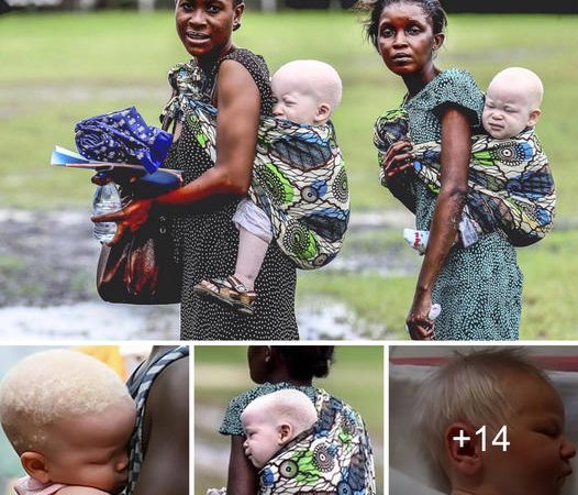 A Woman Gives Birth to Rare Albino Twins with Snow-White Hair!