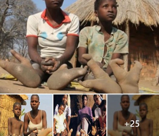 Fascinating encounter: The remarkable ‘pigeon toes’ of Vodoma tribal children